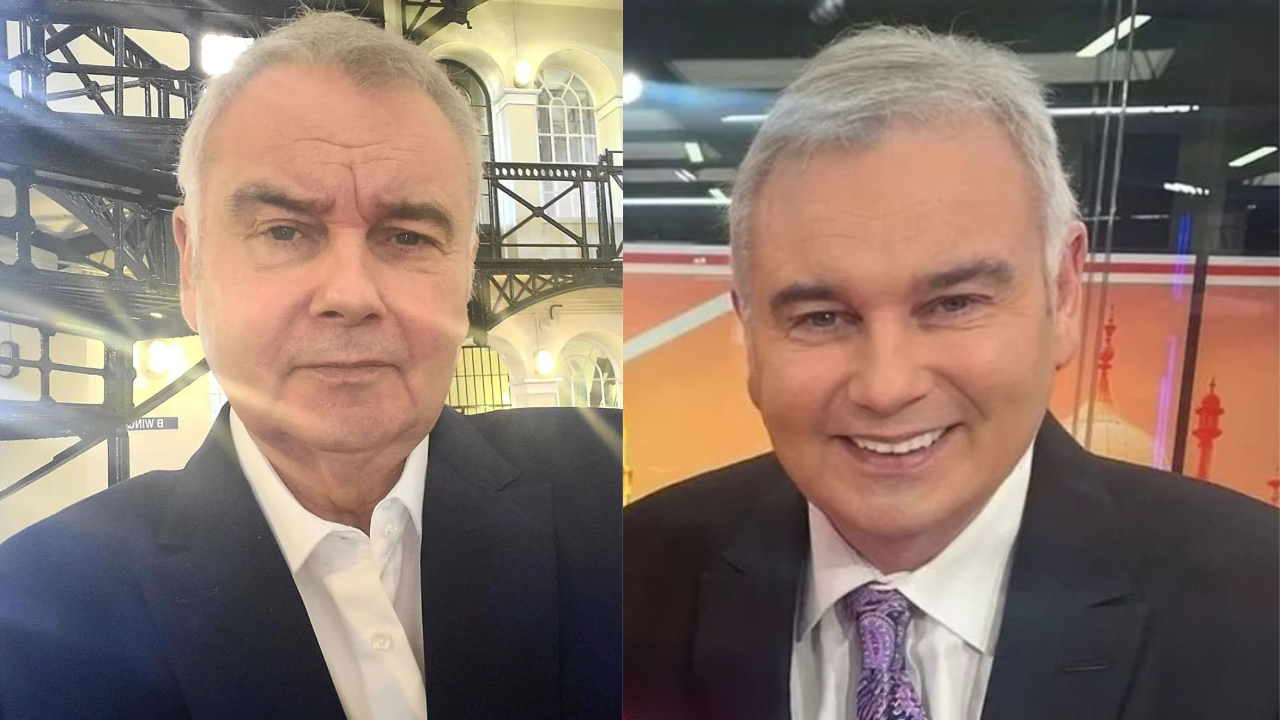 Did Eamonn Holmes Undergo Plastic Surgery to Avoid Aging?