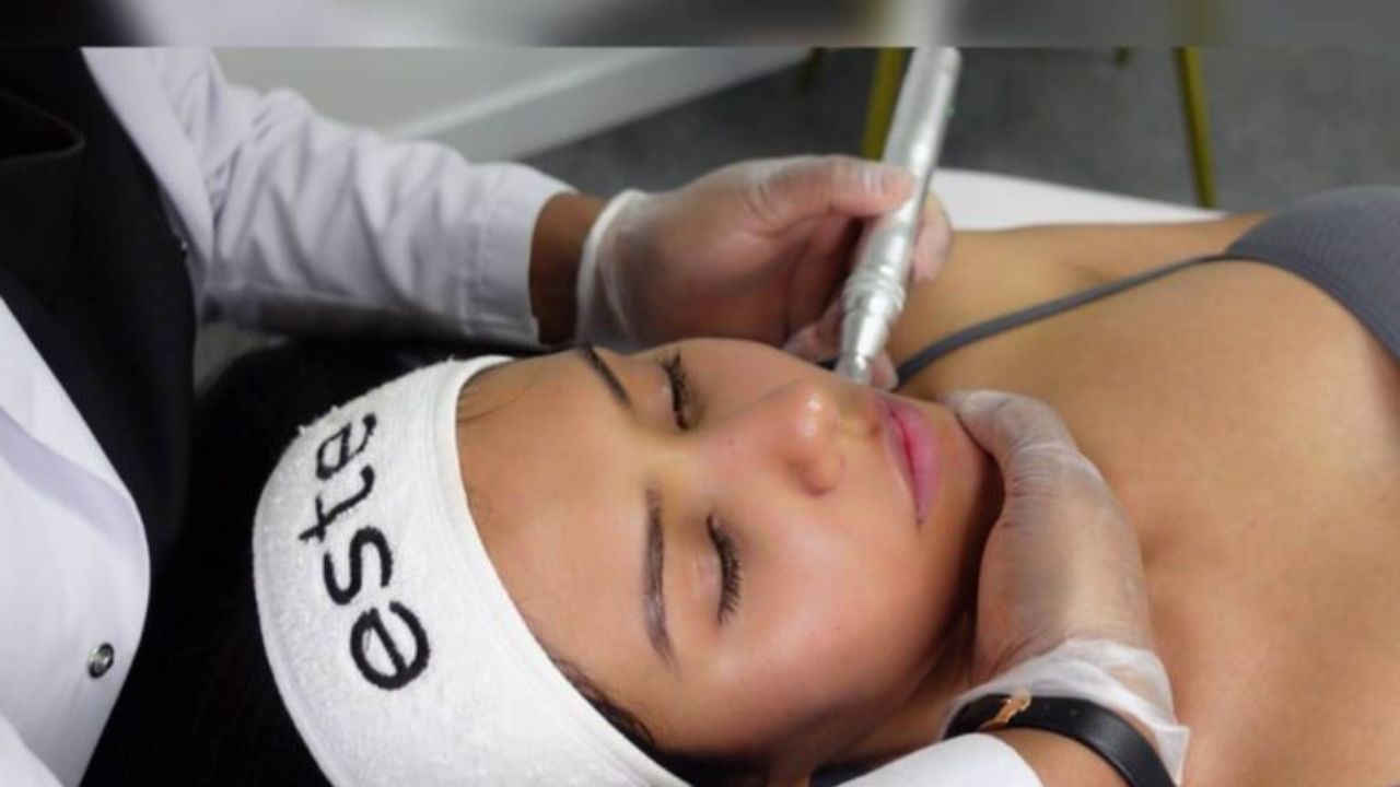 Sonam Bajwa receiving a micro-needling procedure.