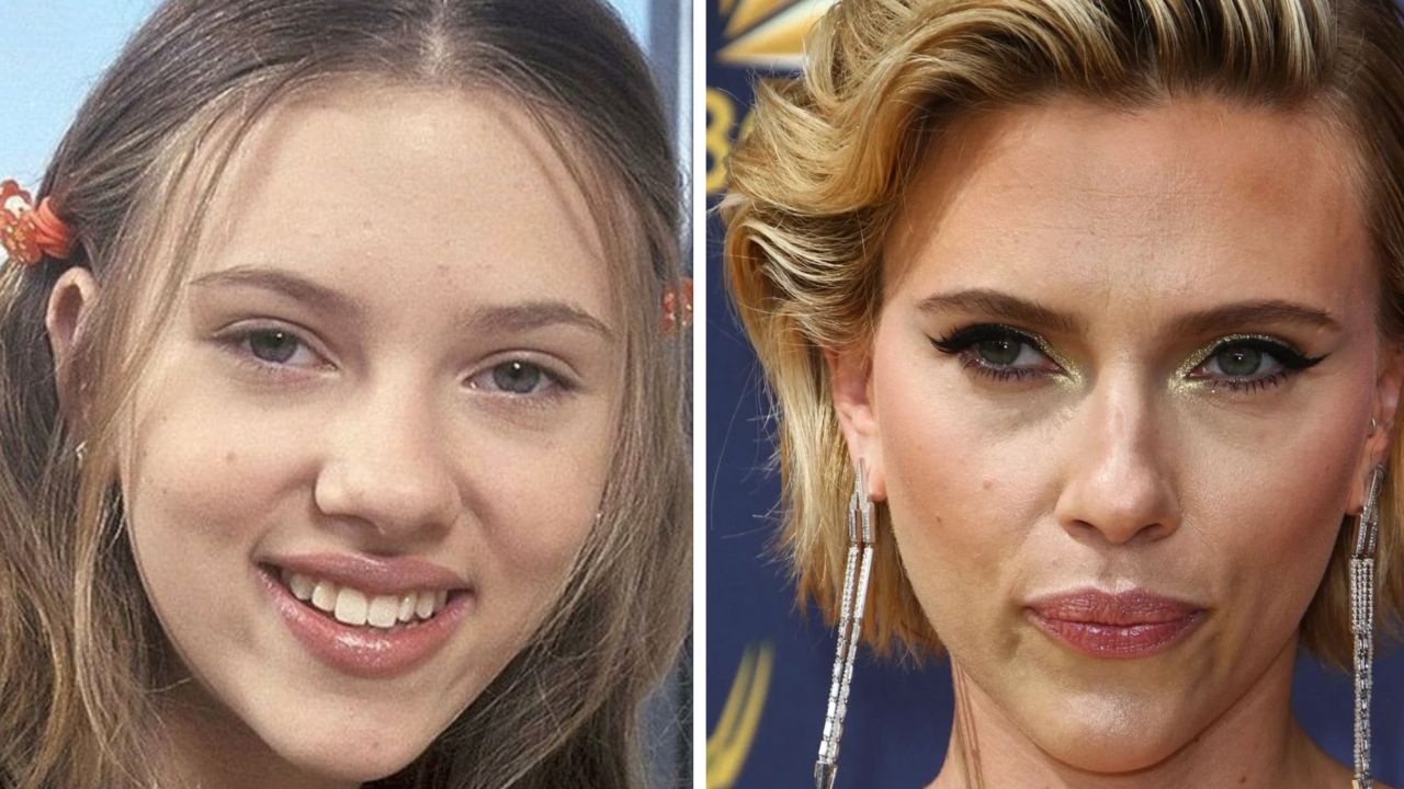 Scarlett Johansson has faced multiple plastic surgery rumors throughout her career, particularly regarding a nose job. spritelybud.com