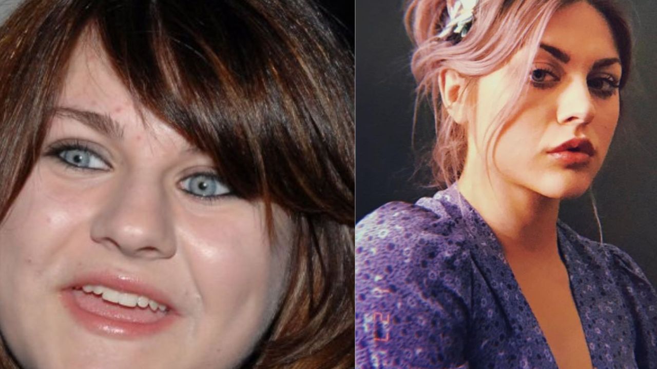Frances Bean Cobain Plastic Surgery: Her Transformation Examined! spritelybud.com
