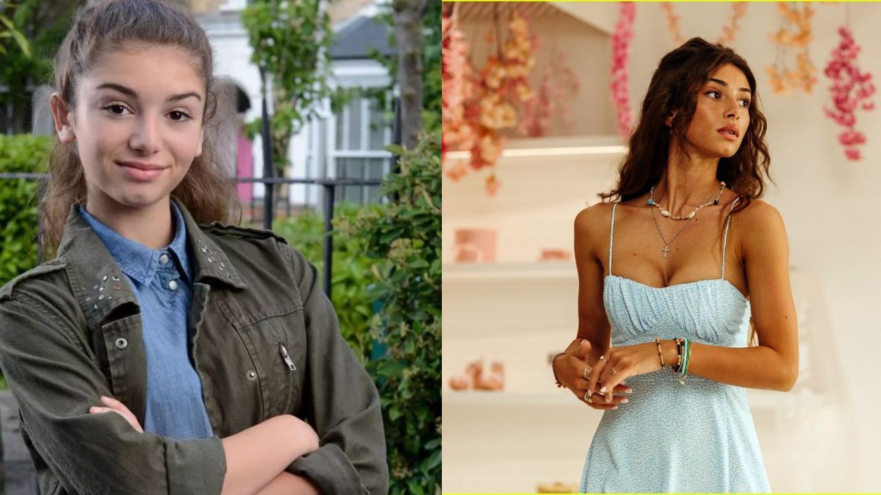 Mimi Keene before and after plastic surgery. spritelybud.com