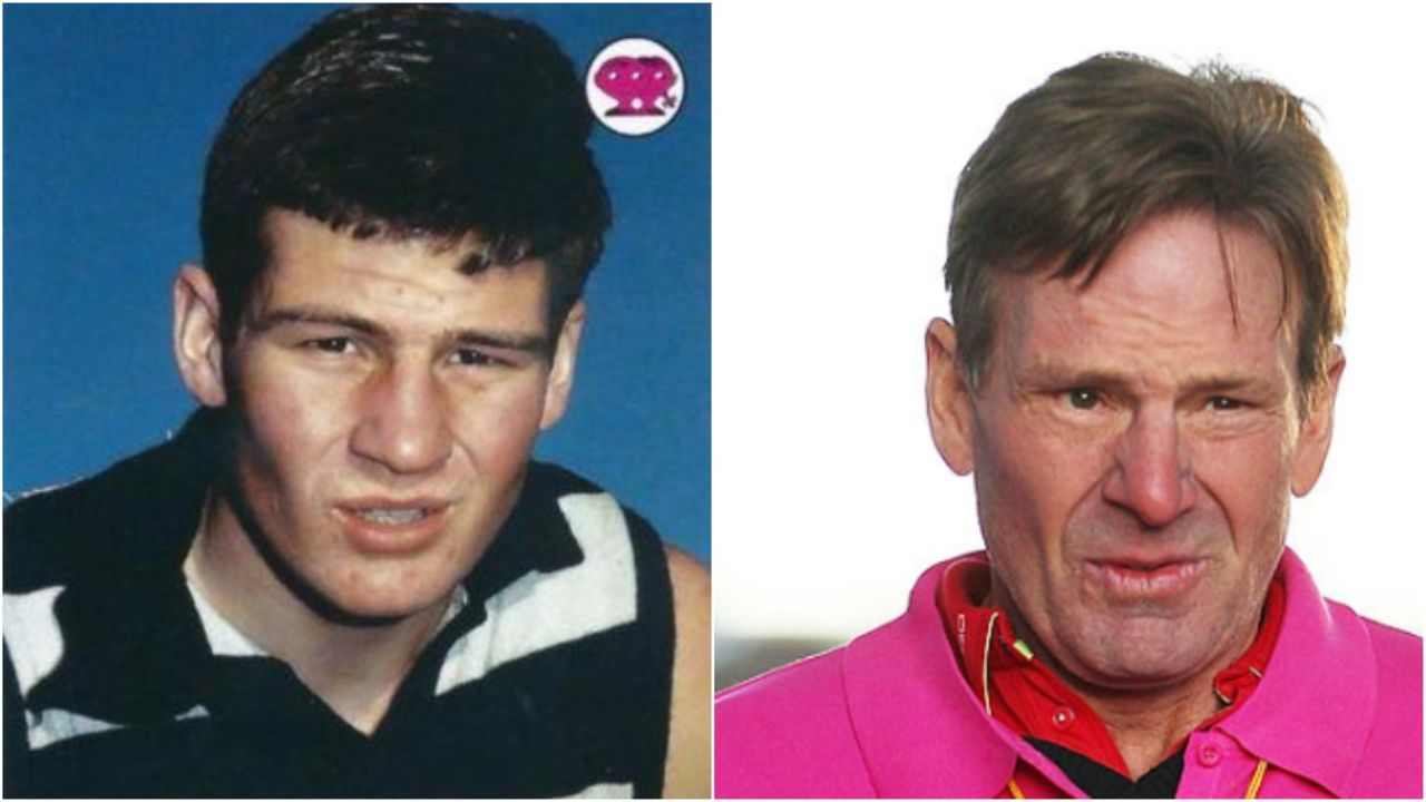Sam Newman before and after plastic surgery. spritelybud.com